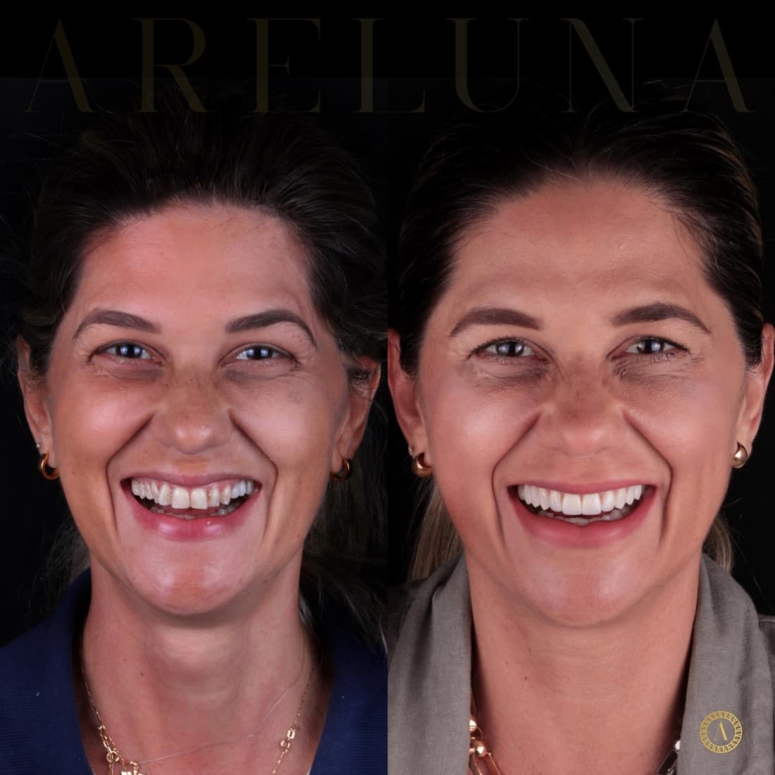 Correção de cor e forma — caso real Instituto Areluna
