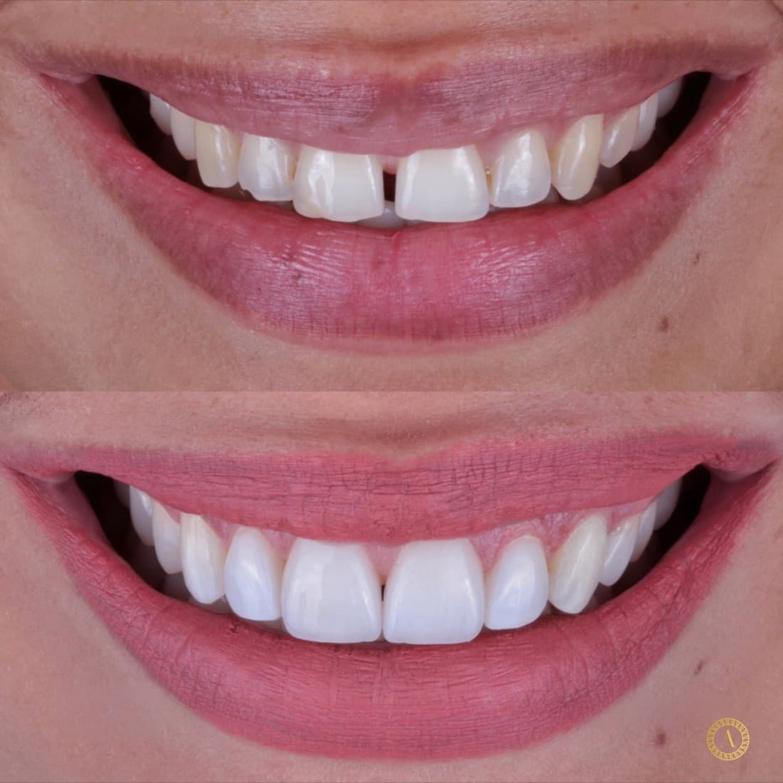 Sorriso desenhado — caso real Instituto Areluna